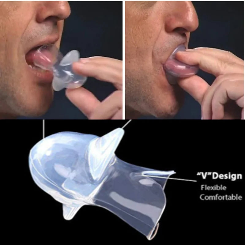 Anti Snoring Mouthpiece worn during sleep to support jaw position and improve airflow